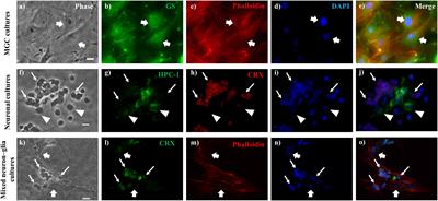 A Defective Crosstalk Between Neurons and <mark class="highlighted">Müller Glial Cells</mark> in the rd1 Retina Impairs the Regenerative Potential of Glial Stem Cells